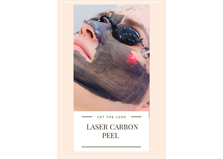 CARBON  PEEL